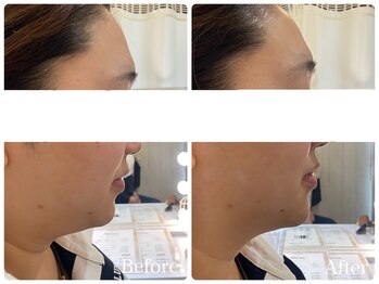 サロン ブーケ(Salon Bouquet)/圧倒的人気☆フェイシャルケア