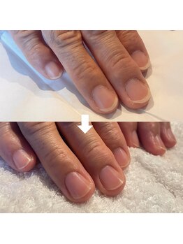 ビビィ(vivie)/縦長のお爪に憧れるお客さまにも