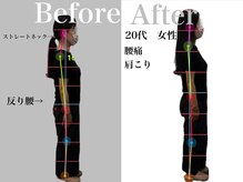リスタート腰痛整体院 舟入院