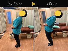 杉本接骨鍼灸院/背骨から全身がユルユル整体