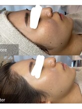 ジェニー(JENNI)/ララピール×LDM