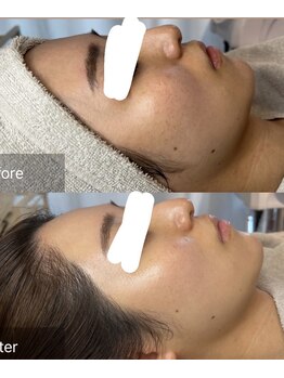 ジェニー(JENNI)/ララピール×LDM