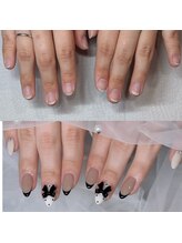 スティムネイル(Stimu nail)/