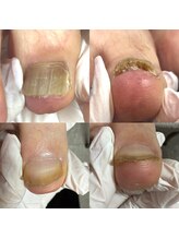 ウェルズユキ(well's yuki)/