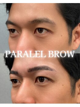 カリス(Charis)/パラレルブロウ