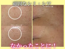 ハニエル(Haniel)の雰囲気（諦めないで大丈夫！頑固なシミ・シワをケアして目指せ-10歳☆）