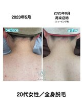 サロンアメリ 御座店(Salon Ameri)/高知　全身脱毛　サロンアメリ