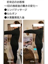 ヨサパーク ライズ 大日(YOSA PARK RISE)/BeforeAfter 