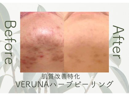 美成(vise)の写真