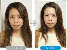 ワト(WATO)/■小顔施術（before→after)