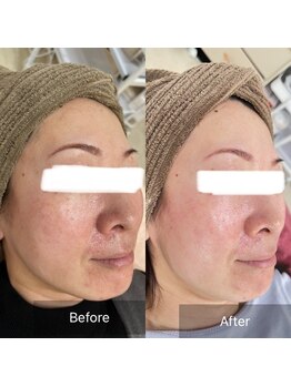 サロン ウイ(salon u'i)/~リブセラ~