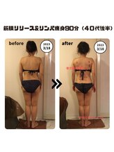 シェルシア(Cielcia)/全身筋膜リリース＆リンパ痩身