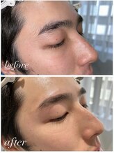 とぅるとぅる/朝7時可 メンズアイブロウwax