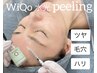 人気No．１【ツヤ肌★WiQo水光ピーリング】コラーゲン促進♪肌質改善◎