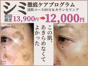 スイッチ(Switch)