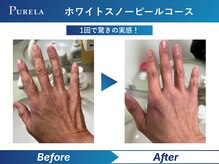 ピュアラ グランピュアラ西梅田店/手肌美人の冬習慣。