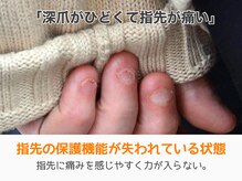 レアム/物を掴んだりペンも握れない。