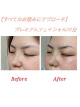 ラトゥール(Latour)/プレミアムフェイシャル75分