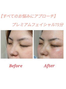 ラトゥール(Latour)/プレミアムフェイシャル75分