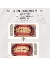 プラスビーセルフ(+b self)/ホワイトニングビフォーアフター