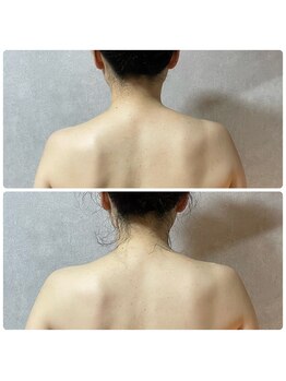 スリーピングビューティー(Sleeping Beauty)/インディバ　姿勢改善