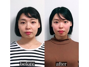 オリノ(Olino)/垢抜け小顔矯正！