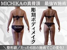 ミチカ(MICHIKA)