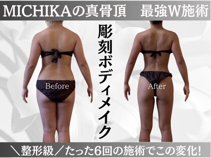 ミチカ(MICHIKA)の写真