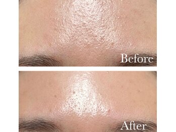 MMK/つるん×つやん=憧れの陶器肌