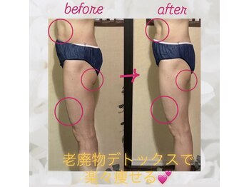 ヨサパーク エトワール 聖蹟桜ヶ丘店(YOSAPARK)/before、after♪