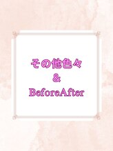 岳鍼灸整骨院/色々＆BeforeAfter