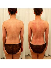 ミールーム(mi room)/約１ヶ月／５回来店