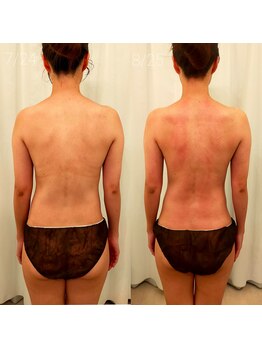 ミールーム(mi room)/約１ヶ月／５回来店