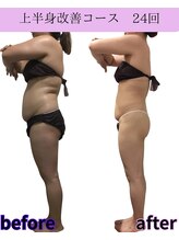 リラ(Lilas)/【痩身】たるみ下半身コース　