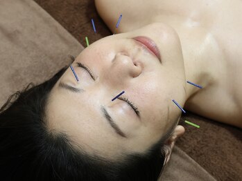 ティルナノーグイリニ(Tir Na Nog-EIRINI)/顔の巡りを整える鍼