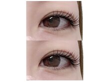 ブライズ(BRISE)/バインドロック