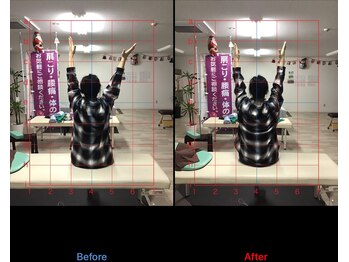 ストレチックス 近江八幡店/姿勢改善ビフォーアフター1回