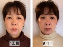 ミヌレ 大阪店(minulle)/本来の若々しく美しいお顔へ戻す