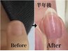 ★自爪育成無料相談★