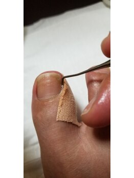 キレイとケンコウの応援サロン杉山/トラブルの原因