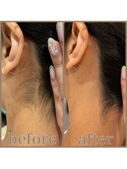 ファビー(Fabby)/シェービング(襟剃り)