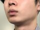シェリール(CHIRIEUR)の写真/【1周年記念限定★男性全身脱毛10000円】都度払い可◎自分のペースで通える♪肌に優しい脱毛で全身キレイ！
