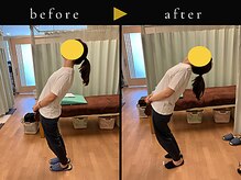 杉本接骨鍼灸院/背骨から全身がユルユル整体