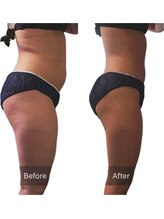 エードット(A.)/before/after