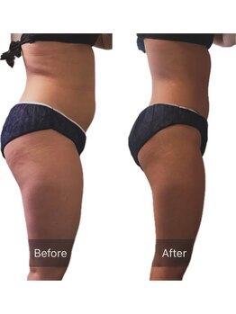 エードット(A.)/before/after