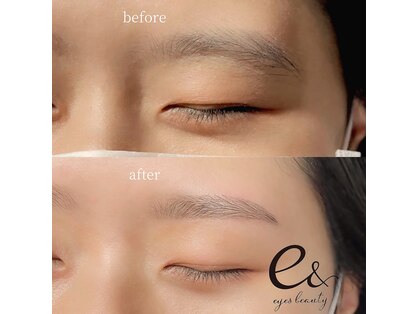 イーアンド アイズビューティー(e& eyes beauty)の写真