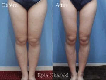 エピア 岡崎店(Epia)/理想のボディラインをゲット