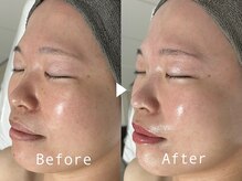 ベルシー(BELTHY)の雰囲気（ノーファンデでも自信が持てる！透明感あふれるうるツヤ肌へ）