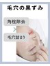 毛穴洗浄（毛穴タイプ診断付）¥16000→