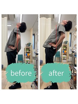 志村三丁目駅前鍼灸院 接骨院/背中（胸椎の）動きの改善